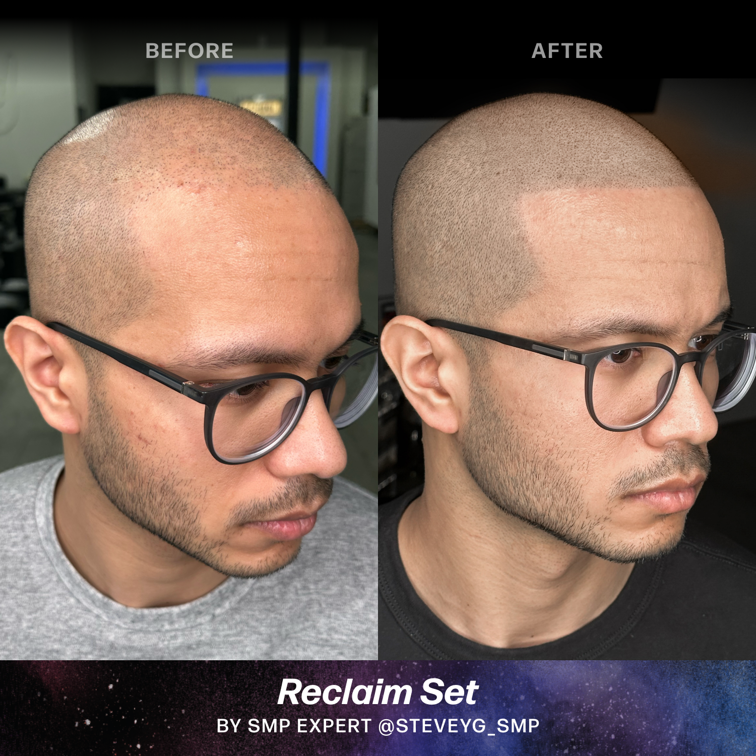 Perma Blend Luxe Stevey G Reclaim Set